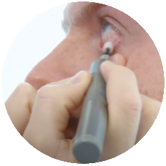 blephex round v1 img-20